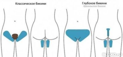 Глубокое бикини и дизайн
