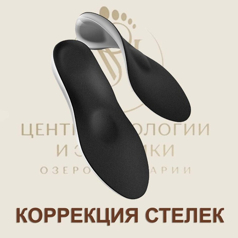 Коррекция стелек